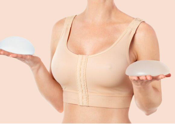 Breast Augmentation