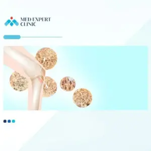 bone density, medexpert clinic