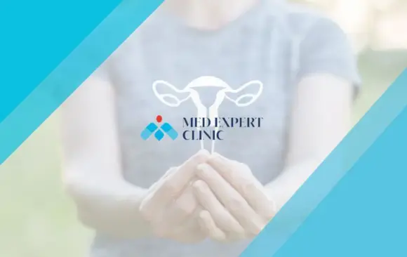 fibroids, medexpert clinic