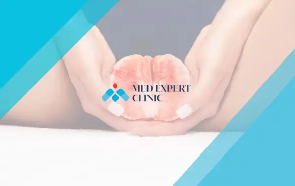 labiaplasty recovery, medexpert clinic