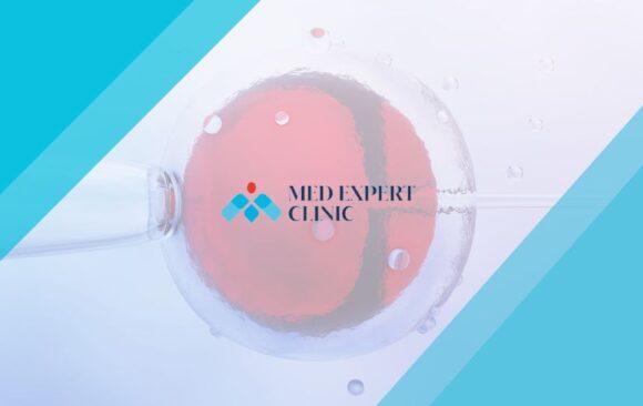 egg freezing, medexpert clinic