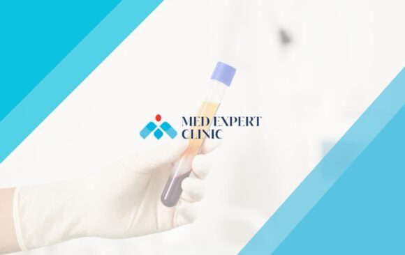 prp therapy, medexpert clinic