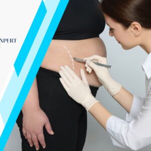 which bariatric surgery, medexpert clinic