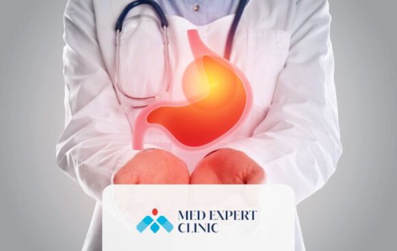 before gastric balloon, medexpert clinic