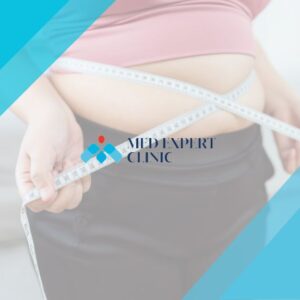 obesity surgery guide, medexpert clinic