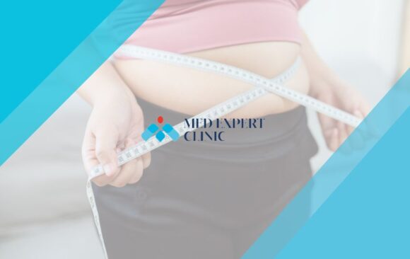 obesity surgery guide, medexpert clinic