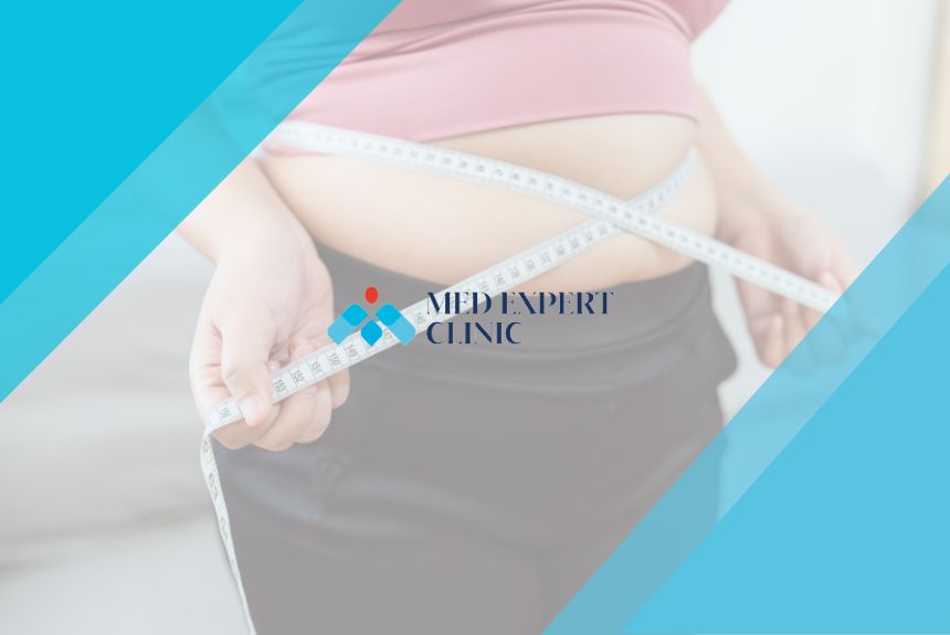 obesity surgery guide, medexpert clinic