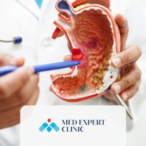 sleeve gastrectomy, medexpert clinic