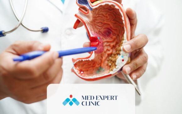 sleeve gastrectomy, medexpert clinic