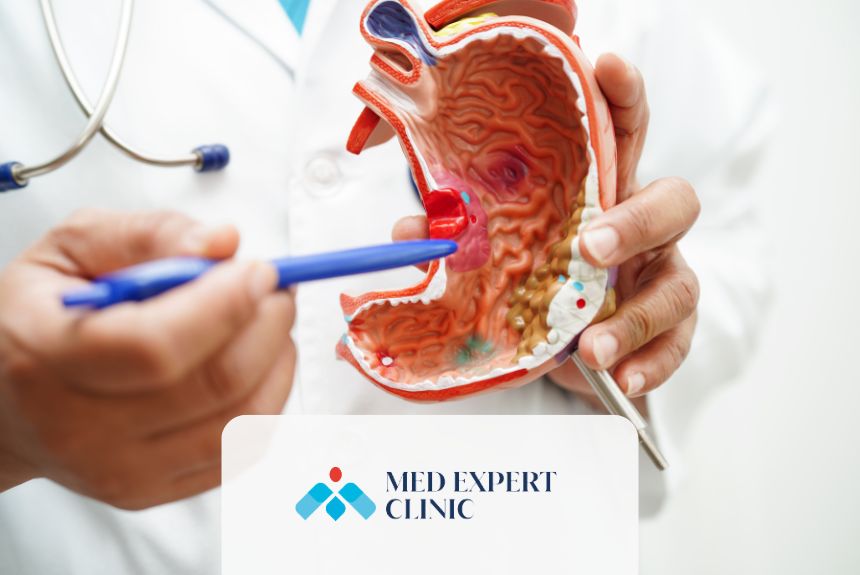 sleeve gastrectomy, medexpert clinic