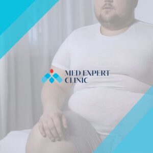 bariatric surgery and heart health, medexpert clinic