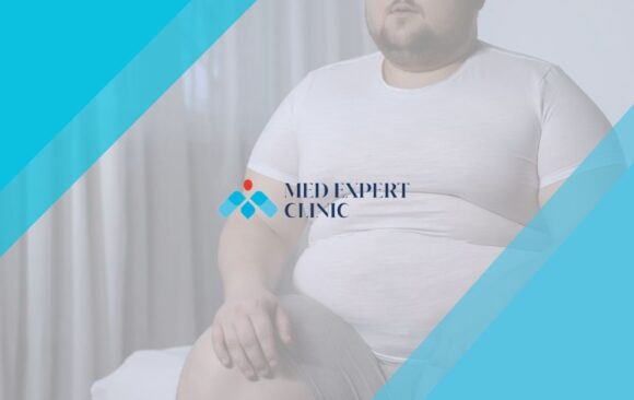 bariatric surgery and heart health, medexpert clinic