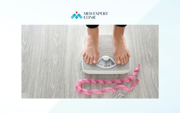 before obesity surgery, medexpert clinic