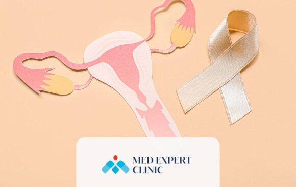 endometriosis and infertility, medexpert clinic