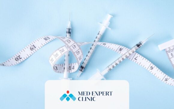 myths about obesity surgery, medexpert clinic