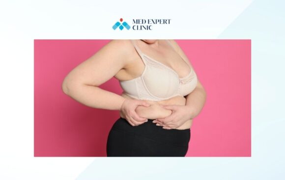 sleeve gastrectomy, medexpert clinic