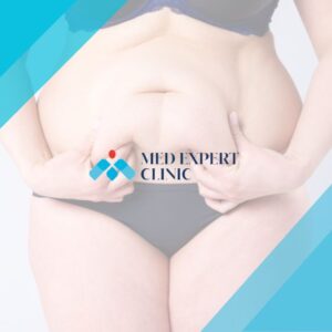 science behind obesity surgery, medexpert clinic