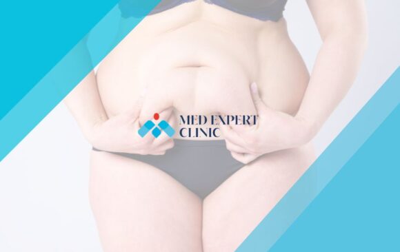 science behind obesity surgery, medexpert clinic