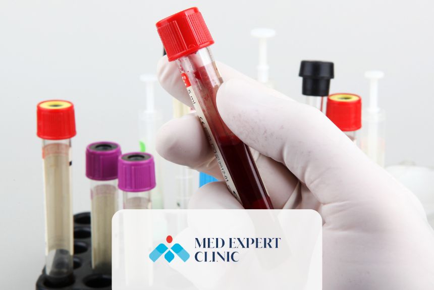 pre-ivf investigations for men, medexpert clinic