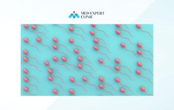 sperm transport problems, medexpert clinic