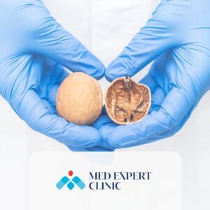 testicular health, medexpert clinic