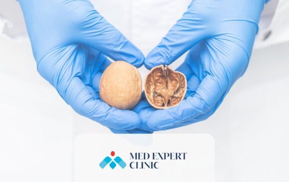 testicular health, medexpert clinic