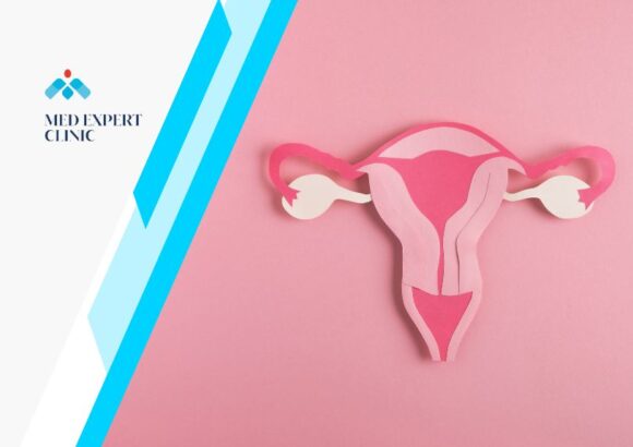 trichomonas vaginalis, medexpert clinic