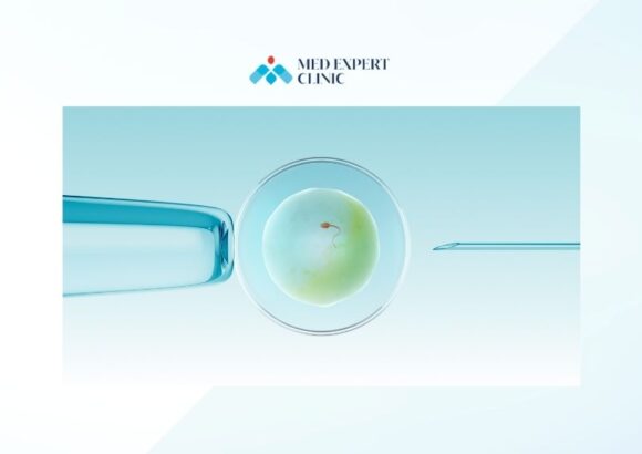 ai and ivf, medexpert clinic