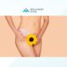 prepare for labiaplasty surgery, medexpert clinic
