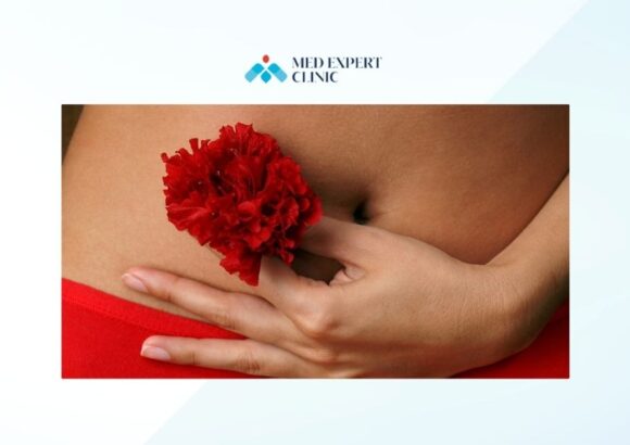 anxiety before labiaplasty, medexpert clinic
